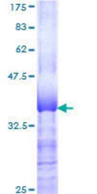 SDS-PAGE Recombinant Human ZNF131 GST (N-Term) Protein