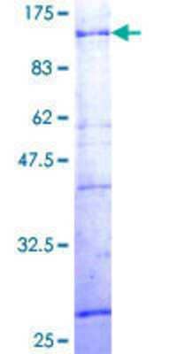 SDS-Page: Recombinant Human ZNF133 Protein [H00007692-P01] - 12.5% SDS-PAGE Stained with Coomassie Blue.