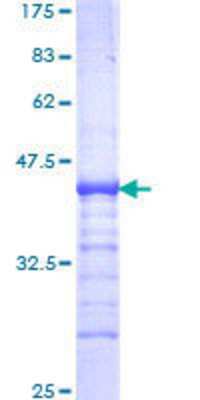 SDS-Page: Recombinant Human ZNF133 Protein [H00007692-Q01] - 12.5% SDS-PAGE Stained with Coomassie Blue.