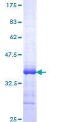 12.5% SDS-PAGE Stained with Coomassie Blue.