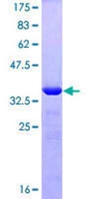 Other Recombinant Human ZNF148 GST (N-Term) Protein