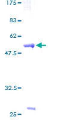 SDS-PAGE Recombinant Human ZNF174 GST (N-Term) Protein