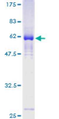 12.5% SDS-PAGE Stained with Coomassie Blue.
