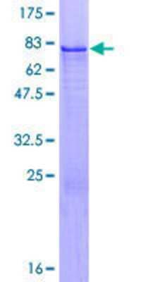 SDS-Page: Recombinant Human ZFP200 Protein [H00007752-P01] - 12.5% SDS-PAGE Stained with Coomassie Blue.
