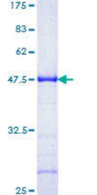 12.5% SDS-PAGE Stained with Coomassie Blue.
