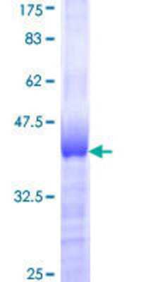 12.5% SDS-PAGE Stained with Coomassie Blue.