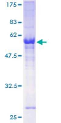 12.5% SDS-PAGE Stained with Coomassie Blue.