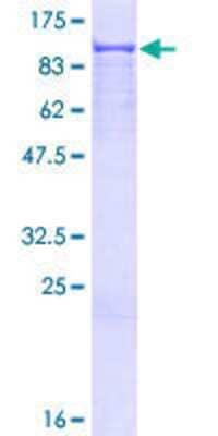 12.5% SDS-PAGE Stained with Coomassie Blue.