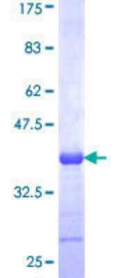 12.5% SDS-PAGE Stained with Coomassie Blue.