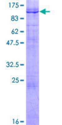 12.5% SDS-PAGE Stained with Coomassie Blue.