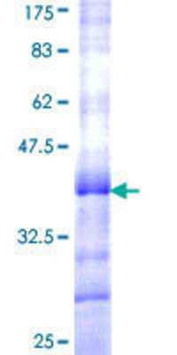 12.5% SDS-PAGE Stained with Coomassie Blue.