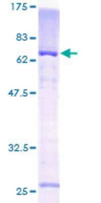 Other Recombinant Human KvBeta1 GST (N-Term) Protein