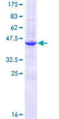 12.5% SDS-PAGE Stained with Coomassie Blue.