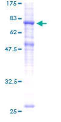 12.5% SDS-PAGE Stained with Coomassie Blue.