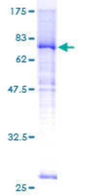 12.5% SDS-PAGE Stained with Coomassie Blue.