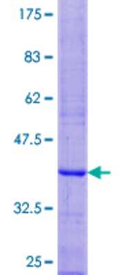 12.5% SDS-PAGE Stained with Coomassie Blue.