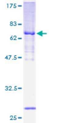 12.5% SDS-PAGE Stained with Coomassie Blue.