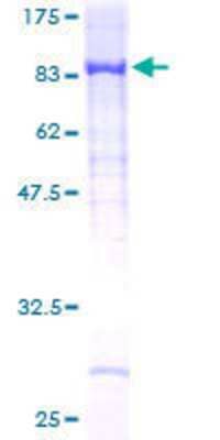 Other Recombinant Human ARHGEF5 GST (N-Term) Protein