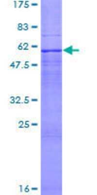 12.5% SDS-PAGE Stained with Coomassie Blue.