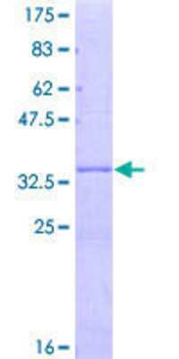12.5% SDS-PAGE Stained with Coomassie Blue.