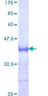 SDS-Page: Recombinant Human AF10 Protein [H00008028-Q01] - 12.5% SDS-PAGE Stained with Coomassie Blue.