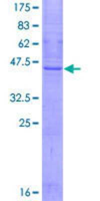 12.5% SDS-PAGE Stained with Coomassie Blue.
