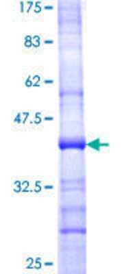 12.5% SDS-PAGE Stained with Coomassie Blue.