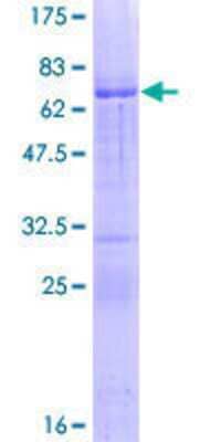 12.5% SDS-PAGE Stained with Coomassie Blue.