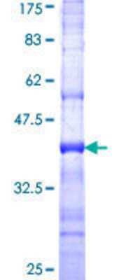 12.5% SDS-PAGE Stained with Coomassie Blue.