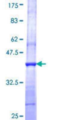 12.5% SDS-PAGE Stained with Coomassie Blue.