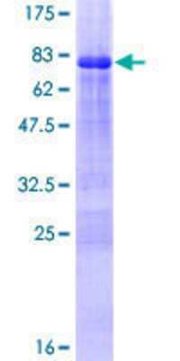 Other Recombinant Human ZNF239 GST (N-Term) Protein