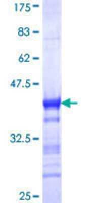 SDS-Page: Recombinant Human RIP140 Protein [H00008204-Q01] - 12.5% SDS-PAGE Stained with Coomassie Blue.