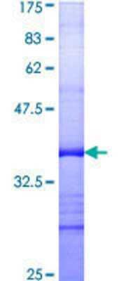 12.5% SDS-PAGE Stained with Coomassie Blue.