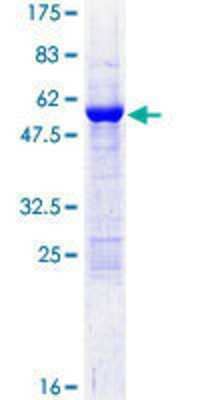 12.5% SDS-PAGE Stained with Coomassie Blue.