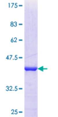 12.5% SDS-PAGE Stained with Coomassie Blue.