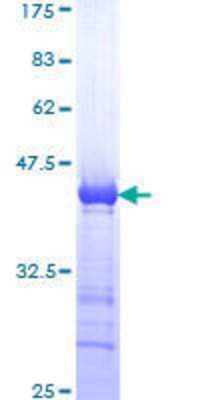 12.5% SDS-PAGE Stained with Coomassie Blue.