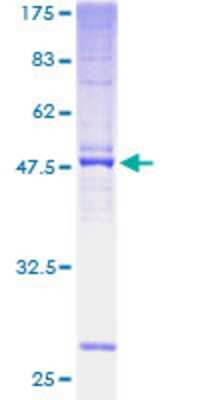 12.5% SDS-PAGE Stained with Coomassie Blue.