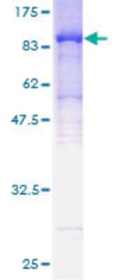 12.5% SDS-PAGE Stained with Coomassie Blue.