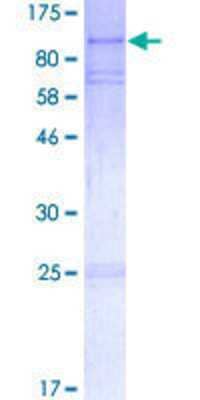 SDS-Page: Recombinant Human EPX Protein [H00008288-P01] - 12.5% SDS-PAGE Stained with Coomassie Blue.