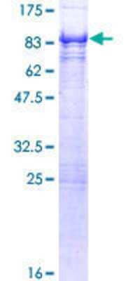 12.5% SDS-PAGE Stained with Coomassie Blue.