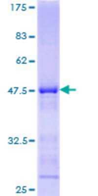 12.5% SDS-PAGE Stained with Coomassie Blue.