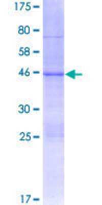 SDS-Page: Recombinant Human Axin-2 Protein [H00008313-P01] - 12.5% SDS-PAGE Stained with Coomassie Blue.