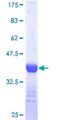 SDS-Page: Recombinant Human EOMES Protein [H00008320-Q01] - 12.5% SDS-PAGE Stained with Coomassie Blue.