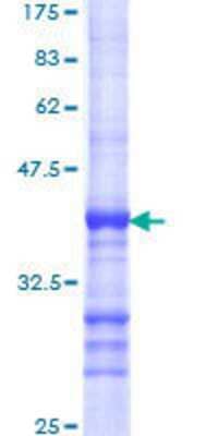 Other Recombinant Human Frizzled-6 GST (N-Term) Protein