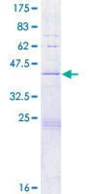 12.5% SDS-PAGE Stained with Coomassie Blue.