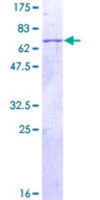 12.5% SDS-PAGE Stained with Coomassie Blue.
