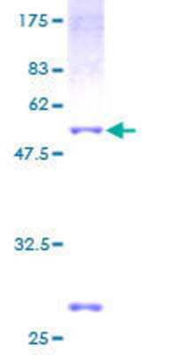 12.5% SDS-PAGE Stained with Coomassie Blue.