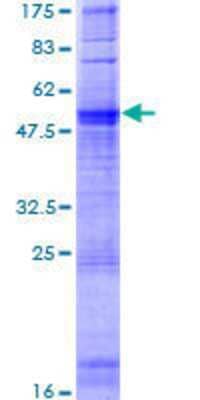 12.5% SDS-PAGE Stained with Coomassie Blue.