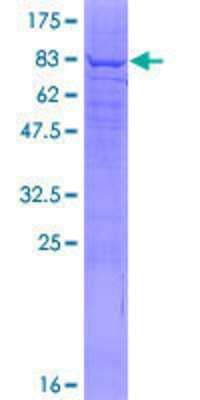 Other Recombinant Human PIP5K1 alpha GST (N-Term) Protein