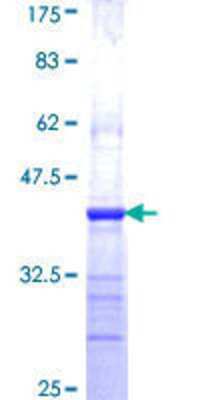 12.5% SDS-PAGE Stained with Coomassie Blue.